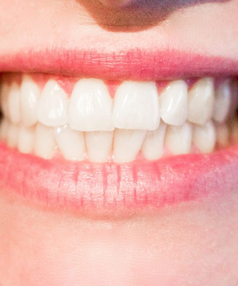 Obecna technika wykorzystywana w salonach stomatologii estetycznej zdoła sprawić, że odbierzemy piękny uśmiech.